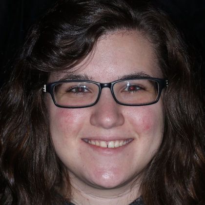 a woman before veneers